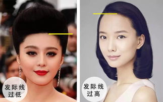 (发际线太低额头窄小)发际线过低，额头狭小的容貌特征及其对外在形象的影响