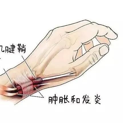 探索未来工业领域的革新者：机械手臂末端执行器的性能分析与应用展望